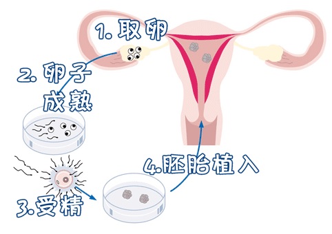 试管代生包性别